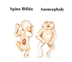 anens
