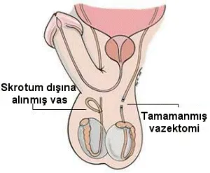 vaz_2